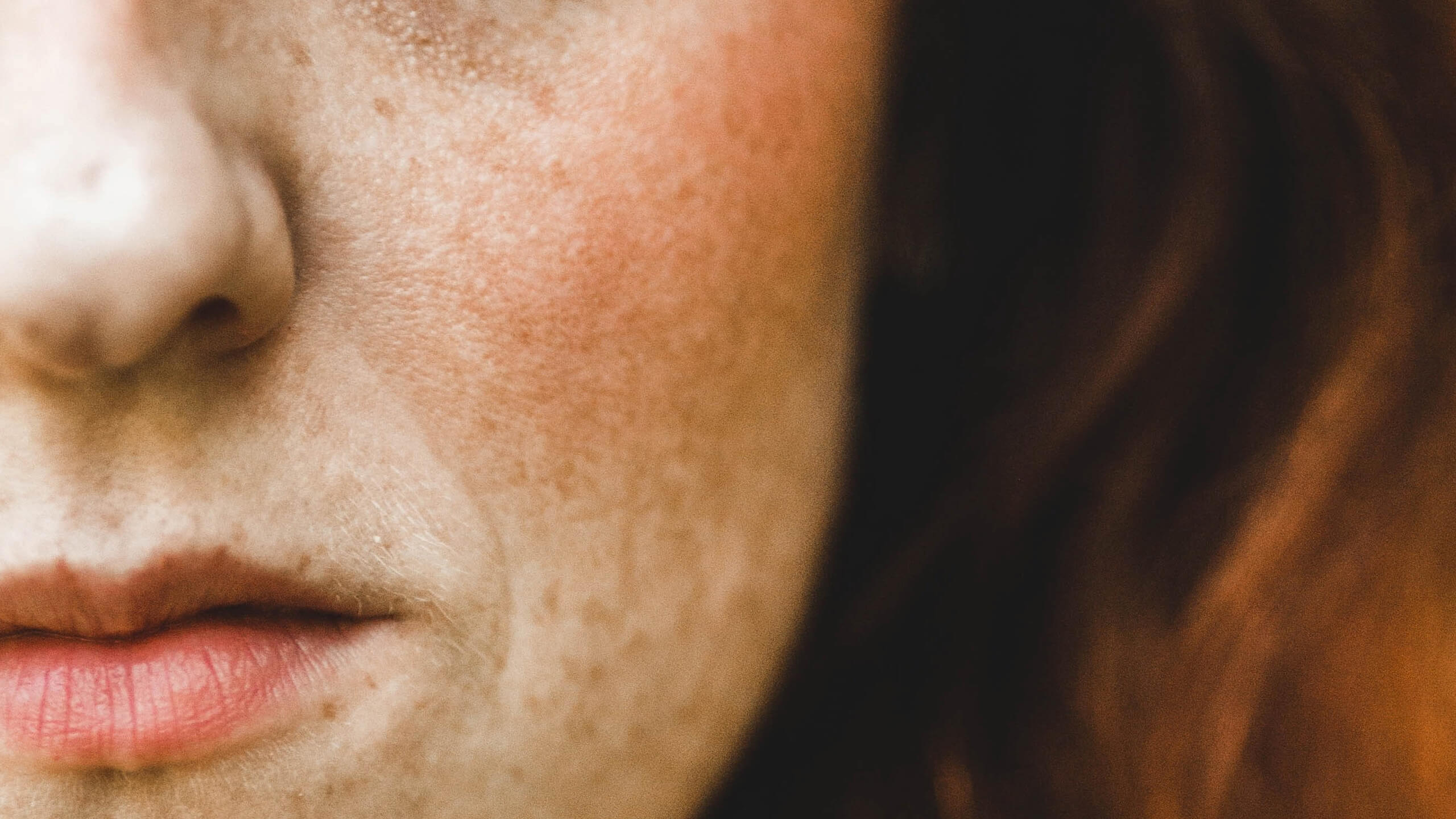 Acido azelaico contro acne e macchie: le proprietà